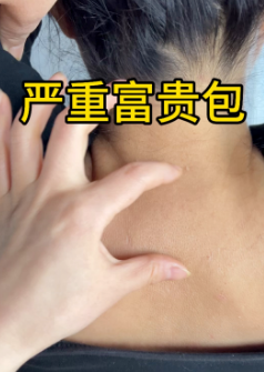 富贵包