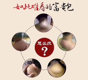 富贵包