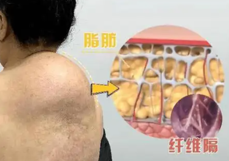 富贵包