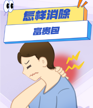 富贵包