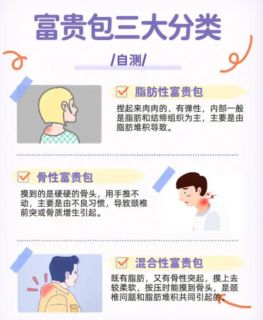 富贵包