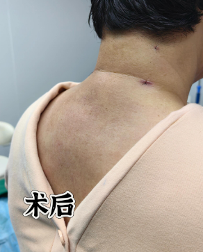 富贵包