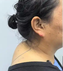 富贵包
