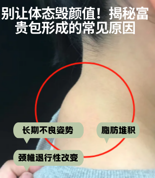 富贵包
