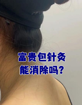 富贵包