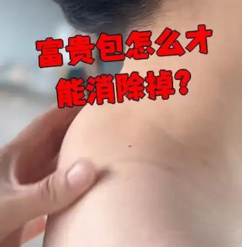富贵包