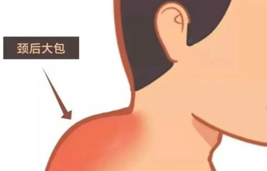 富贵包