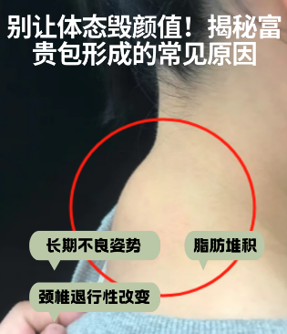 富贵包