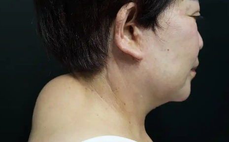 富贵包