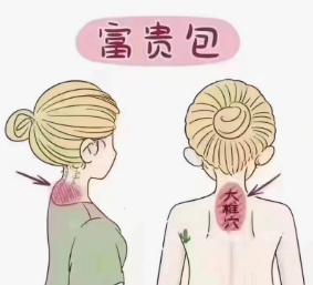 富贵包