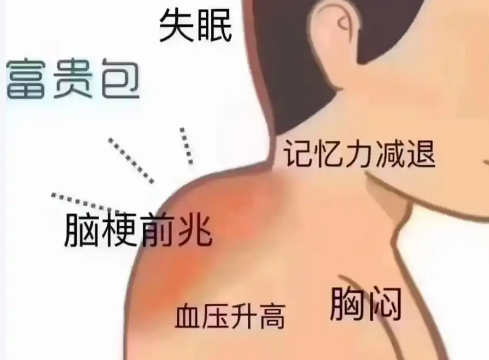 富贵包