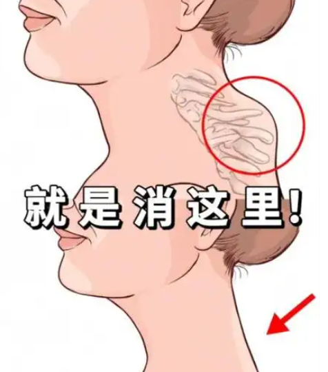 富贵包