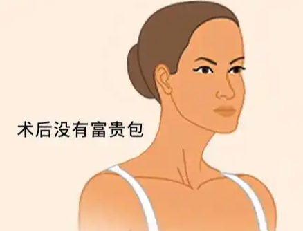 富贵包