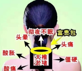 富贵包