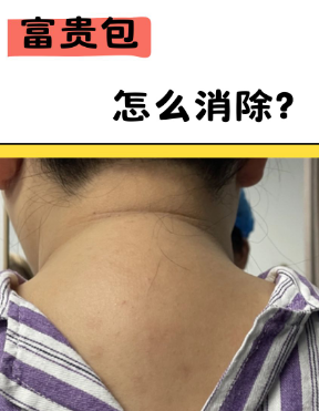 富贵包