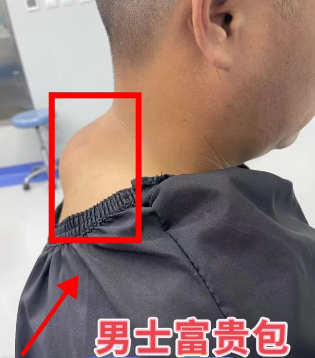 富贵包