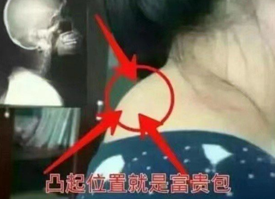 富贵包