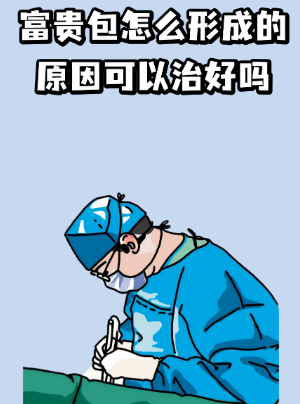 富贵包