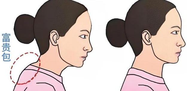 富贵包
