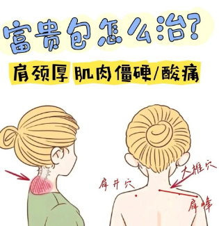 富贵包