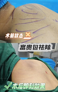 富贵包