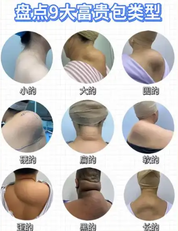 富贵包