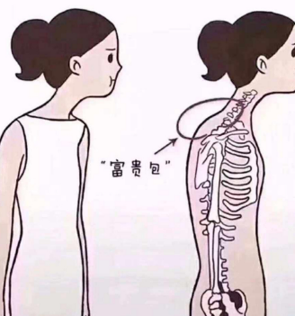 富贵包