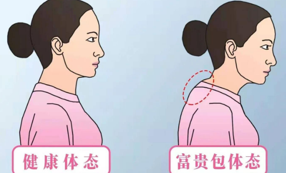 富贵包