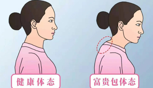 富贵包