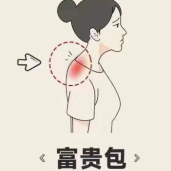 富贵包
