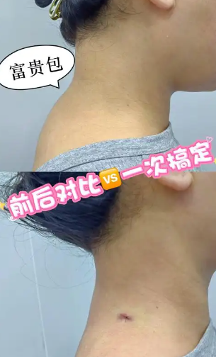 富贵包