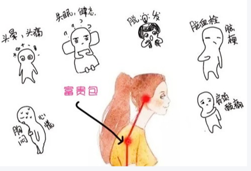 富贵包