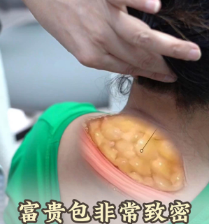 富贵包
