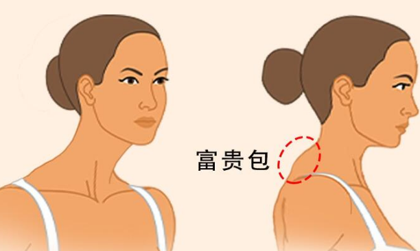 富贵包