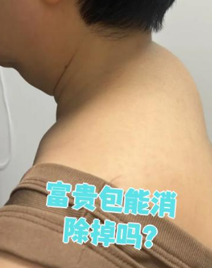 富贵包