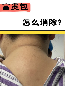 富贵包