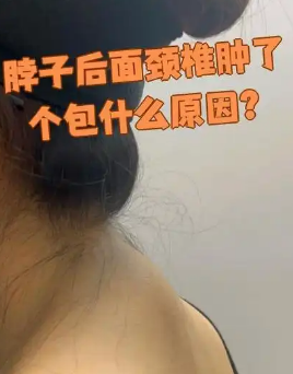 富贵包