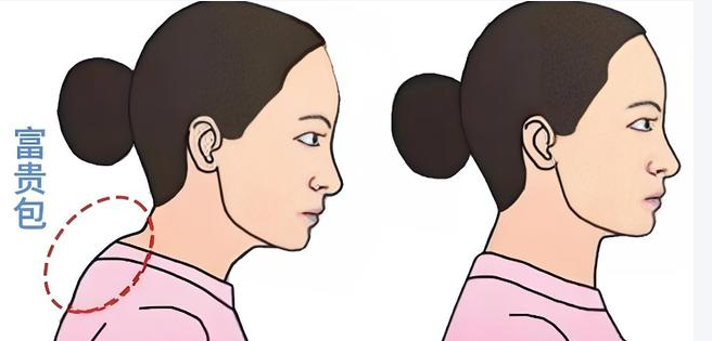 富贵包