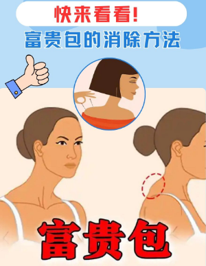 富贵包