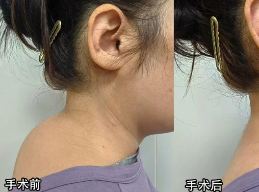 富贵包