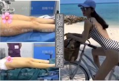 重庆超雅的超声波减肥在形体雕塑中优势
