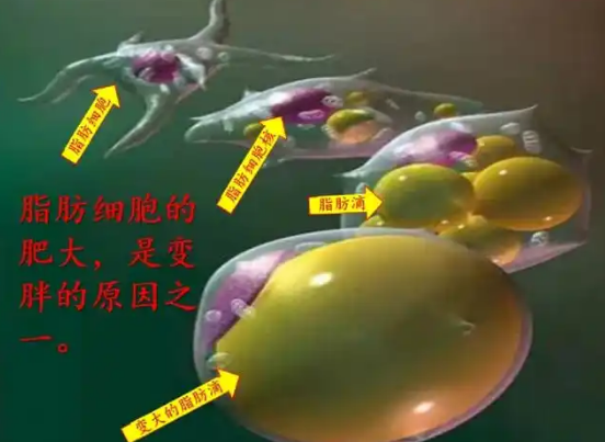 超声波减肥
