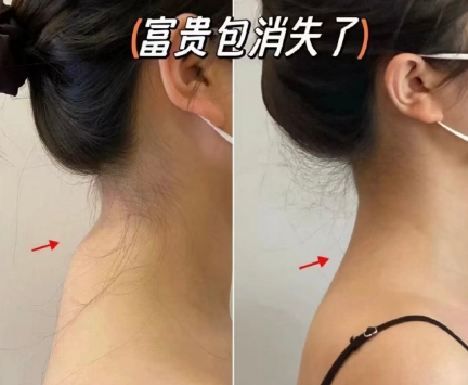富贵包