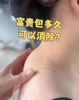富贵包