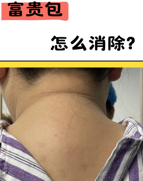富贵包