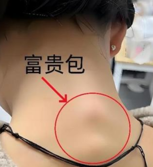 富贵包