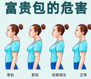 富贵包