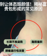 梁杰做的超声波去富贵包效果怎么样？