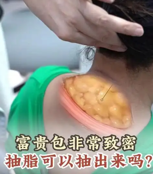 富贵包