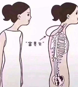 富贵包
